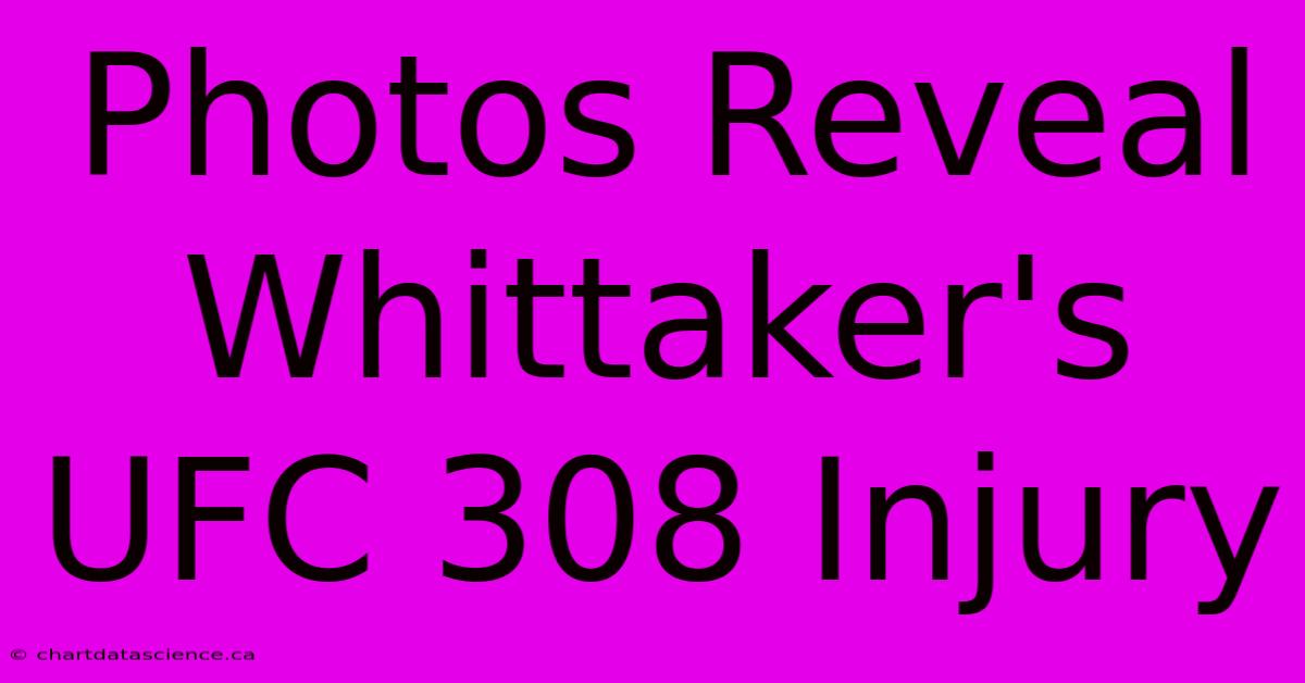 Photos Reveal Whittaker's UFC 308 Injury