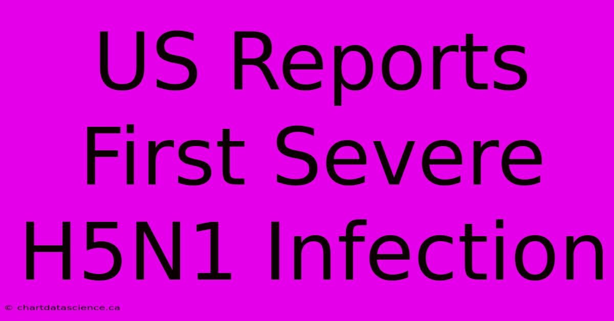 US Reports First Severe H5N1 Infection