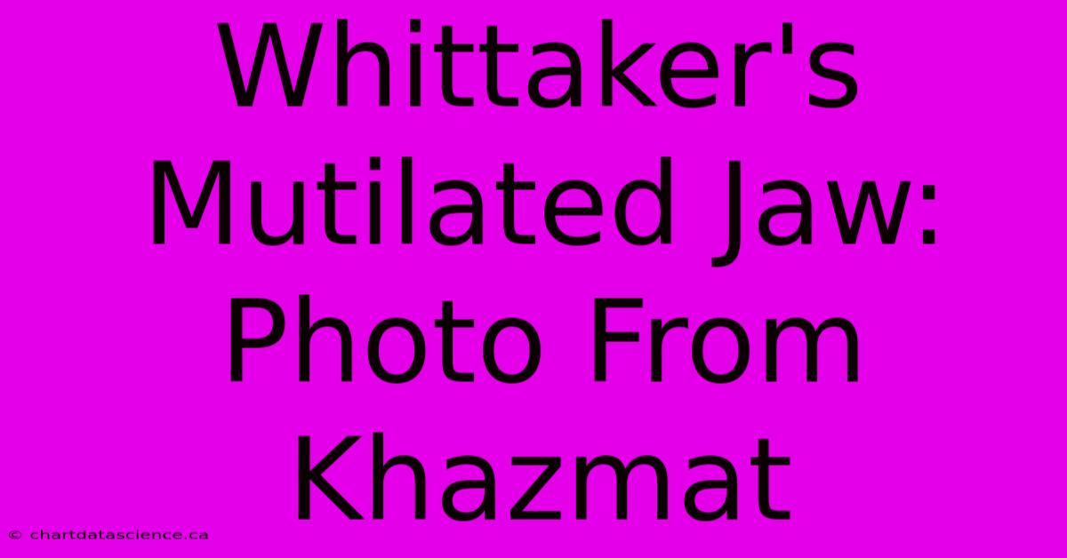 Whittaker's Mutilated Jaw: Photo From Khazmat